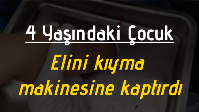 4 yaşındaki çocuk elini kıyma makinesine kaptırdı